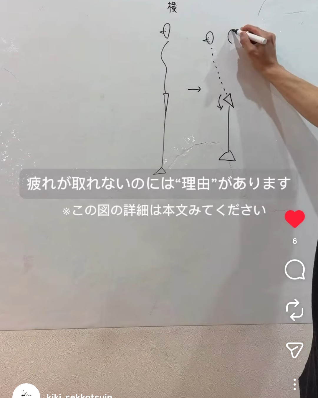 きき接骨院整体院 多賀城中野栄院のホワイトボードの説明