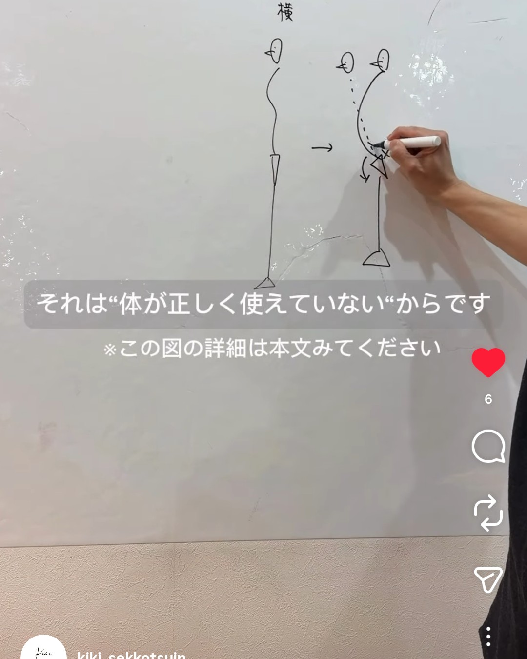 きき接骨院整体院 多賀城中野栄院のホワイトボードの説明