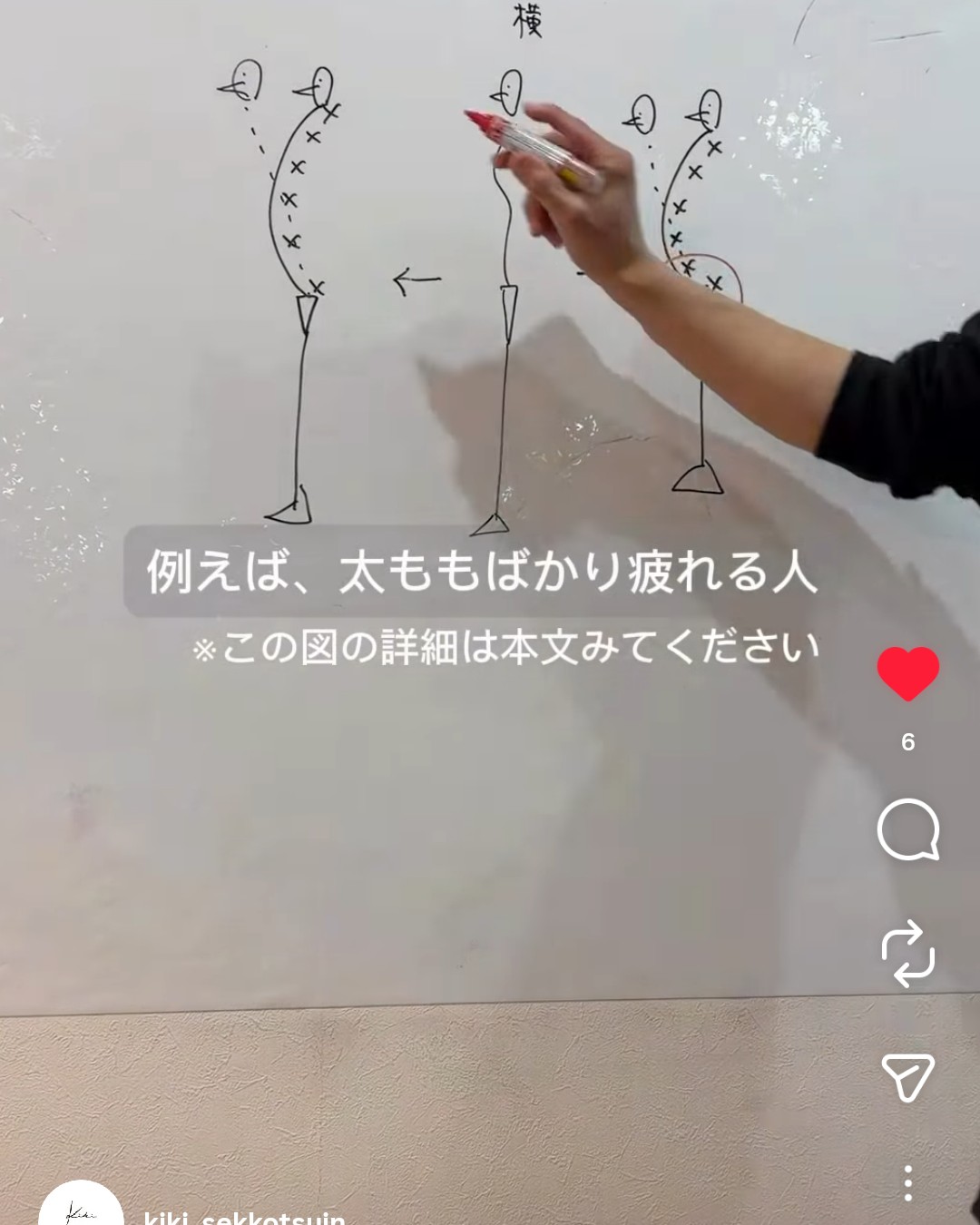 きき接骨院整体院 多賀城中野栄院のホワイトボードの説明